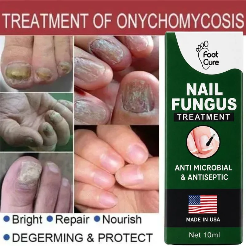 Fast Nail Fungus Treatment Serum | Nail Repair Essence for Fingernails & Toenails | Natural Nail Care Formula - Image 2
