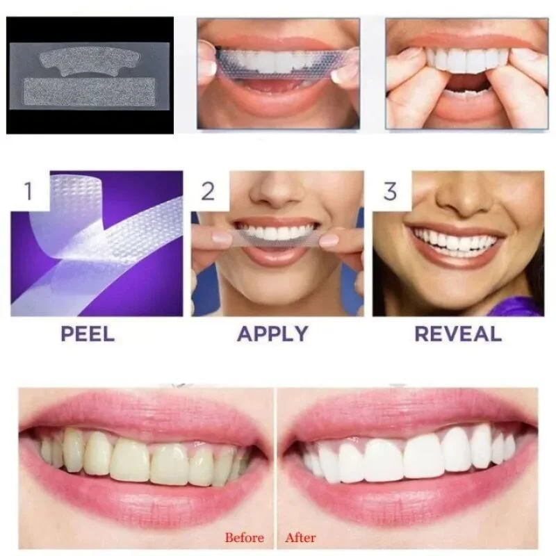 Gegemoon 5D Teeth Whitening Strips | Professional 5-Day Whitening Kit | Enamel Safe Teeth Whitening Strips | Deep Stain Removal | Mint Flavor | 7 Pairs - Image 7
