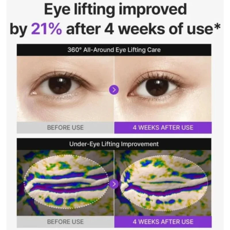 Centellian24 360° Shot PDRN Lifting Eye Cream | Anti-Aging Eye Cream for Wrinkles, Puffiness & Dark Circles | Firming & Hydrating Formula | 30ml - Image 6