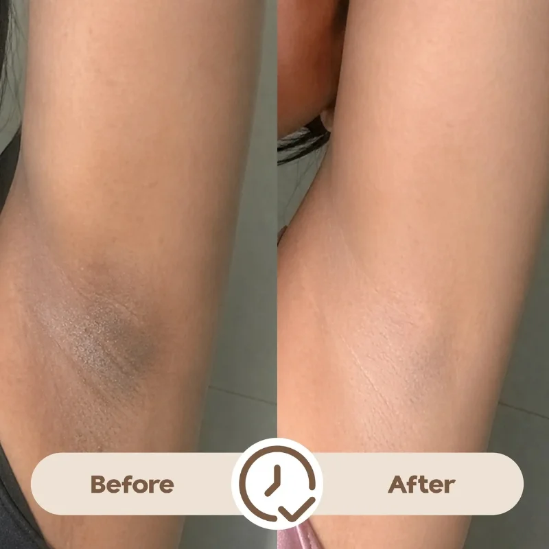Ray Time To Shine Underarm Serum | Brightening Underarm Serum with Niacinamide, Alpha Arbutin & Hyaluronic Acid | Lightweight Daily Care | 30ml - Image 4